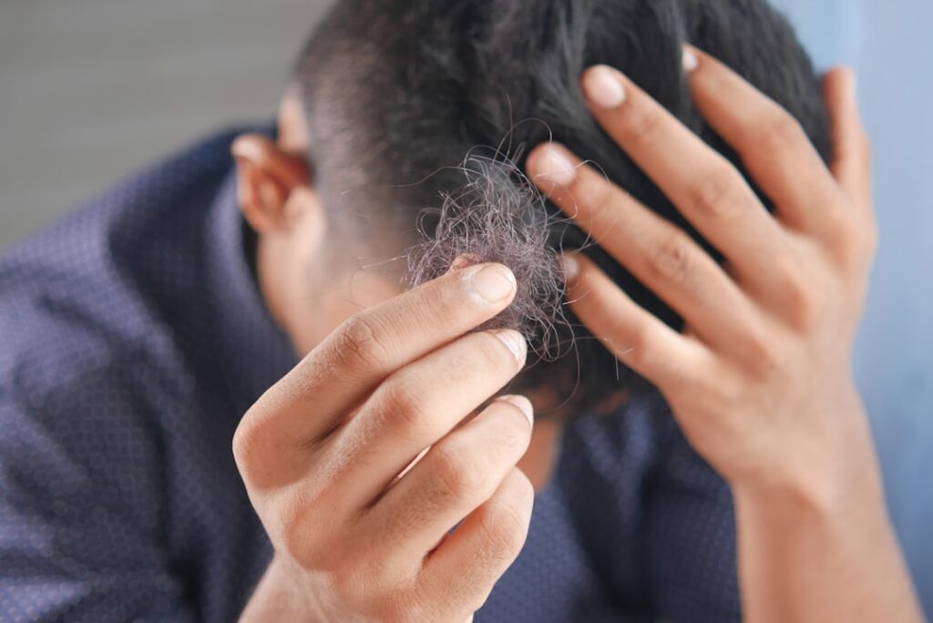 Nektar Presents 52-Week Alopecia Areata Trial Results a man is combing his hair with his hands
